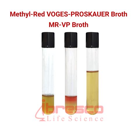 Methyl Red and Voges.